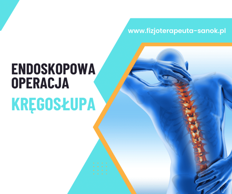Endoskopowa operacja kręgosłupa, fizjoterapeuta Sanok