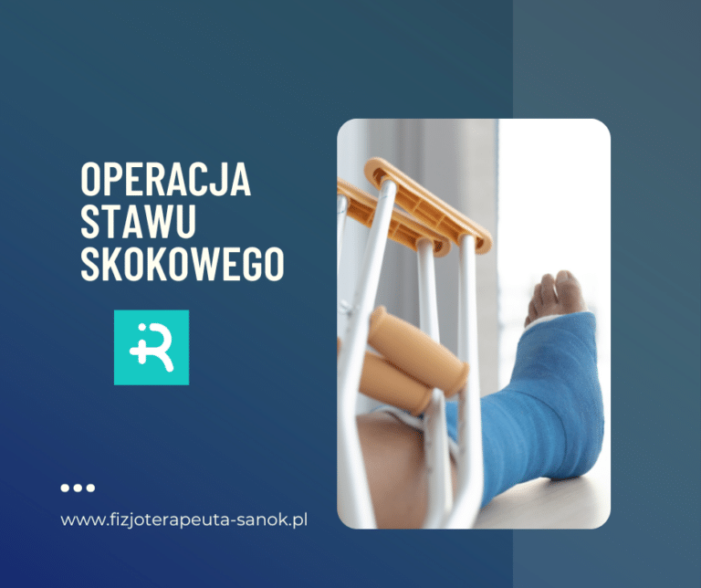 Operacja stawu skokowego, noga w gipsie