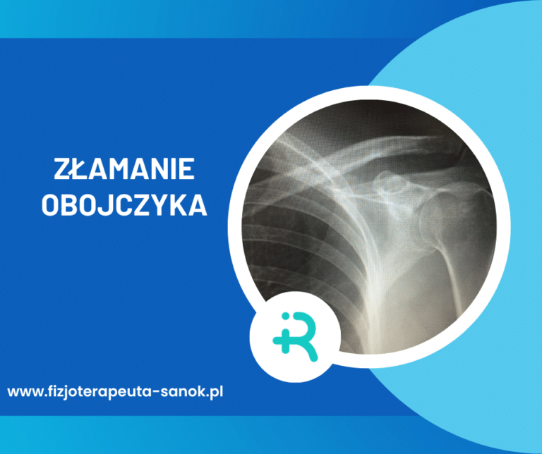 RTG złamania obojczyka