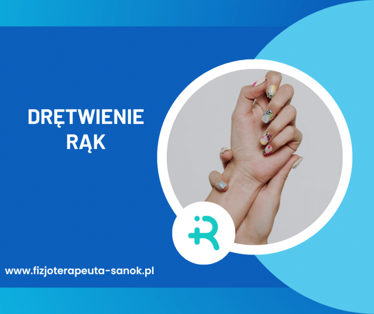Fizjoterapeuta Sanok - Drętwienie rąk