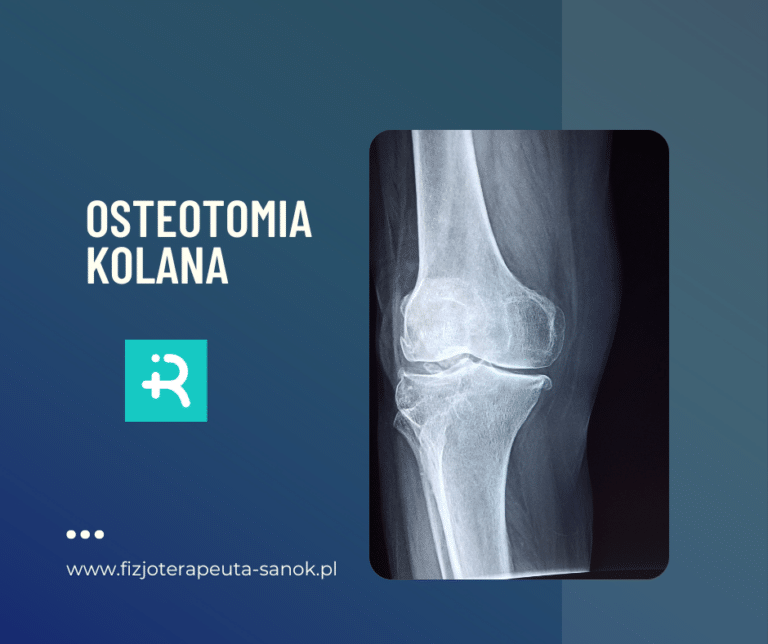 RTG kolana - osteotomia, fizjoterapia w Sanoku