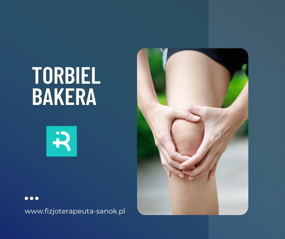 Dłoń trzymająca kolano z torbielą Bakera