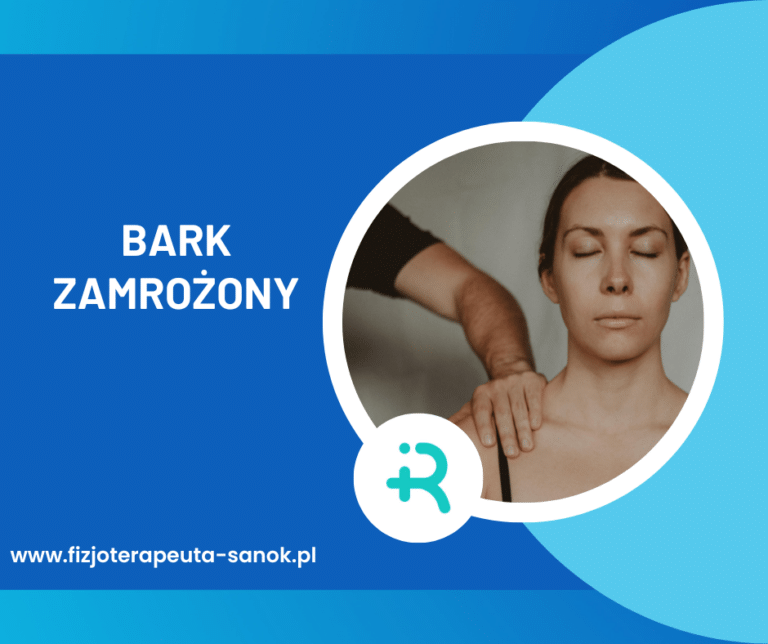 Fizjoterapia na zamrożony bark