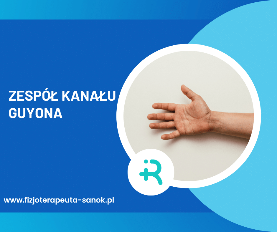 Zespół kanału Guyona, fizjoterapia ręki