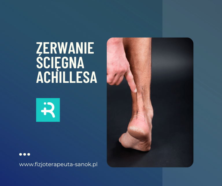 Zerwanie ścięgna Achillesa - www.fizjoterapeuta-sanok.pl