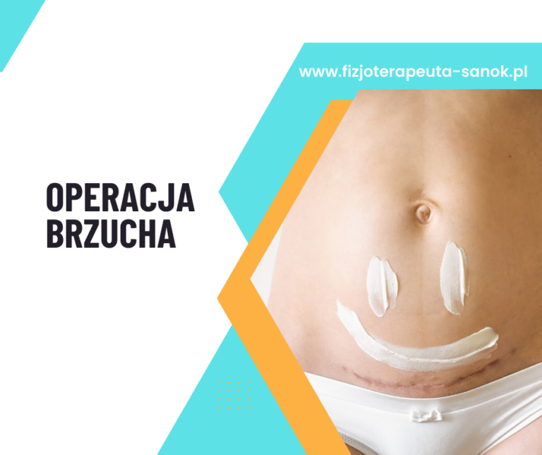 Operacja brzucha, strona fizjoterapeuty.