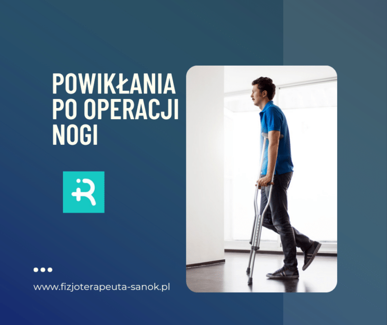 Powikłania po operacji nogi – fizjoterapia.