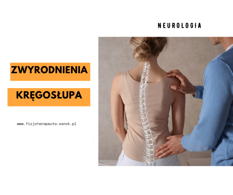 Neurologia: zwyrodnienia kręgosłupa, fizjoterapeuta Sanok