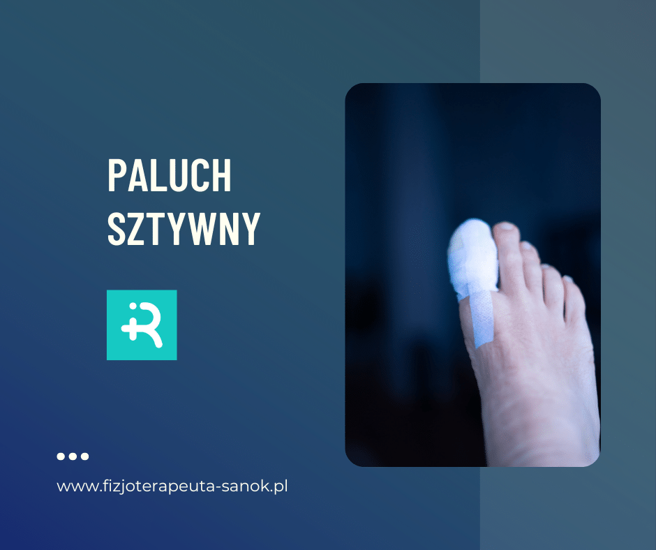 Skręcony paluch u nogi, leczenie.