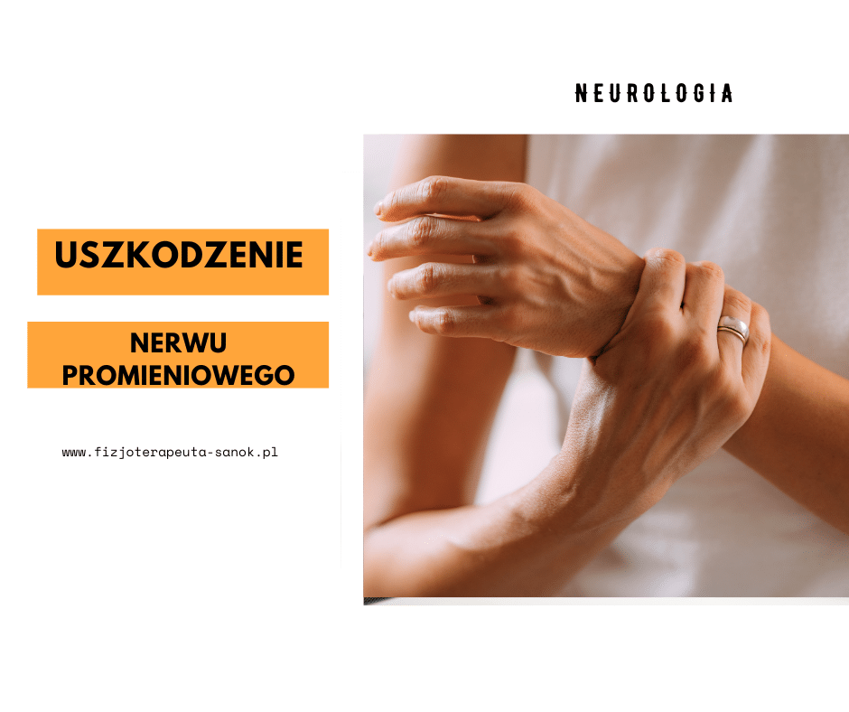 Uszkodzenie nerwu promieniowego w neurologii.