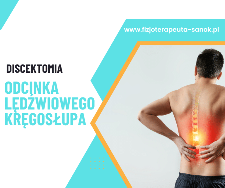 Discektomia lędźwiowego odcinka kręgosłupa, fizjoterapeuta.