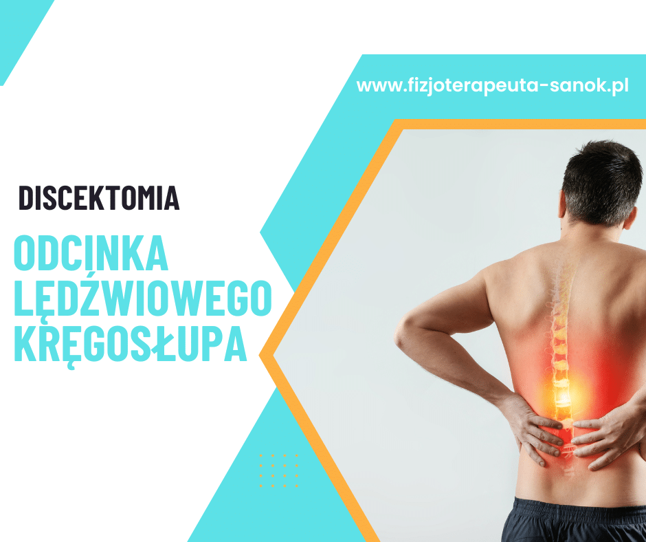 Discektomia lędźwiowego odcinka kręgosłupa, fizjoterapeuta.