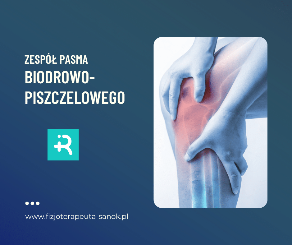 Ból kolana, zespół pasma biodrowo-piszczelowego, fizjoterapia.